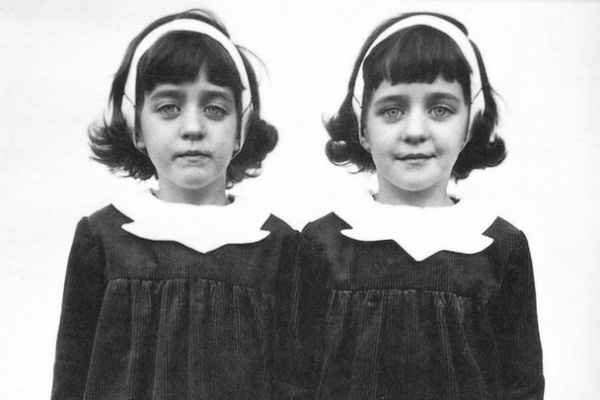 Cặp sinh đôi kỳ lạ: Sống cùng với ký ức của 2 người chị quá cố, giống đến cả nỗi sợ hãi và cách ăn không ai giải thích được-3