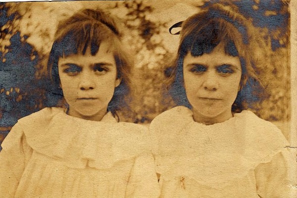 Cặp sinh đôi kỳ lạ: Sống cùng với ký ức của 2 người chị quá cố, giống đến cả nỗi sợ hãi và cách ăn không ai giải thích được-4