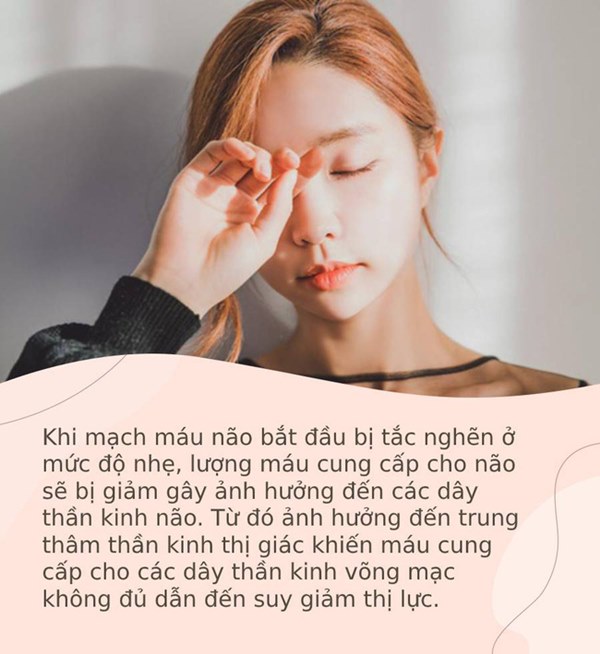 Nếu xuất hiện 4 biểu hiện này, nên đi khám và kiểm tra kịp thời vì rất có thể bạn đang mắc chứng nhồi máu não mà không hề biết-2