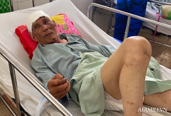 TP.HCM: Bệnh viện khẩn tìm người thân cho cụ ông bị té đập đầu mê sảng, không có ai bên cạnh-2