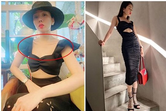 Lệ Quyên ngày càng gầy đét, chân tay khẳng khiu thiếu quyến rũ