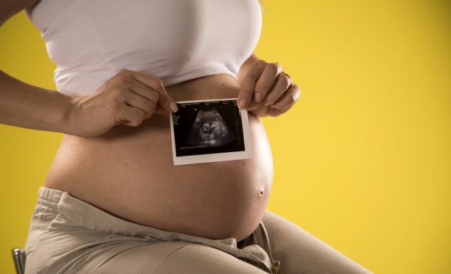 Trẻ sinh mổ thông minh hơn trẻ sinh thường ? Câu trả lời sẽ khiến bạn bất ngờ-2