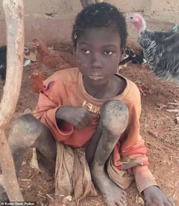 Bé trai bị xích, phải ăn thức ăn gia súc trong khi bố sống với 3 vợ, 17 con khác-1