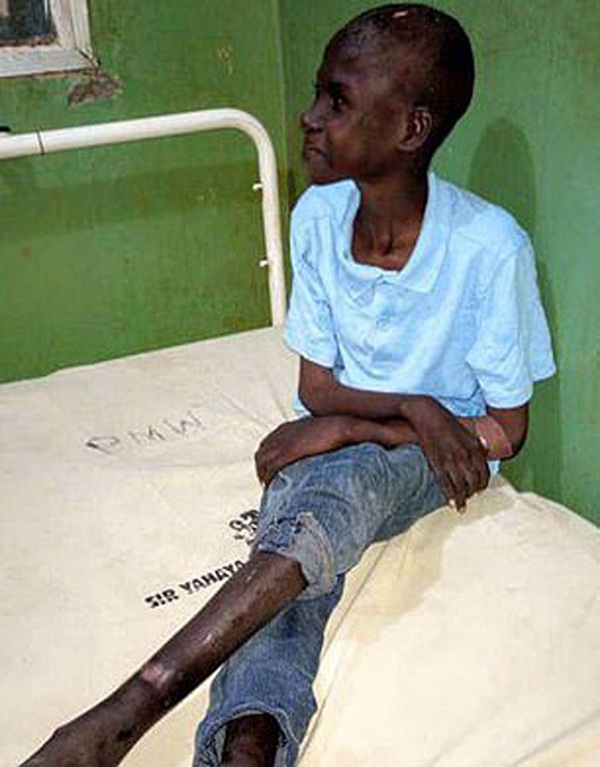 Bé trai bị xích, phải ăn thức ăn gia súc trong khi bố sống với 3 vợ, 17 con khác-2