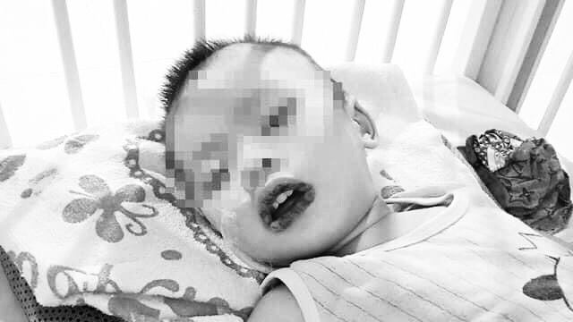 Bé gần 2 tuổi uống nhầm thuốc tẩy bồn cầu-1