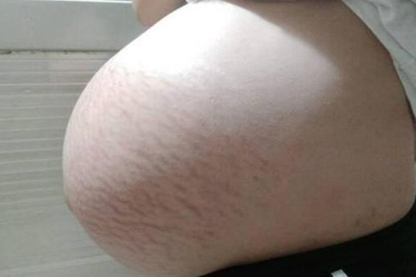 Vào phòng sinh cùng vợ được chứng kiến cảnh khâu tầng sinh môn khiến chồng sợ tái mặt, ám ảnh cả năm không dám nói chuyện gối chăn-4