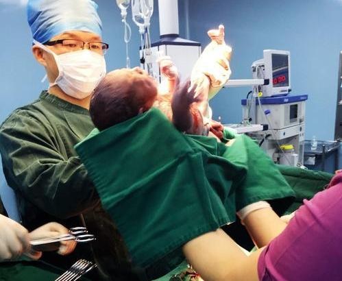 Em bé cười ngay khi chào đời ngay lập tức bị bác sĩ tát, mẹ cám ơn rối rít-2
