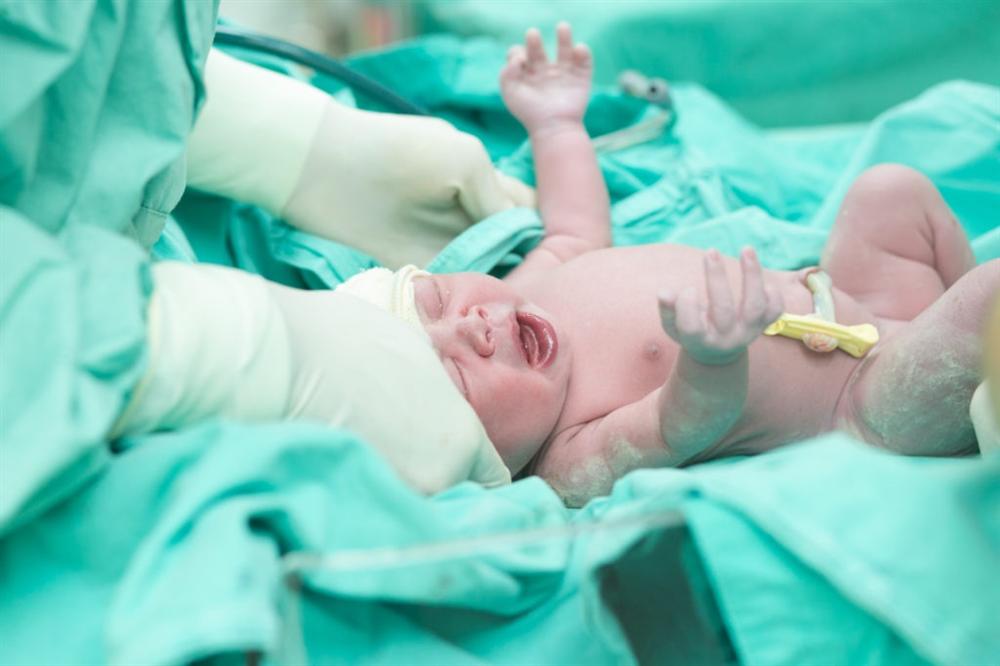 Em bé cười ngay khi chào đời ngay lập tức bị bác sĩ tát, mẹ cám ơn rối rít-3