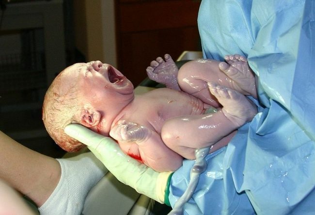 Em bé cười ngay khi chào đời ngay lập tức bị bác sĩ tát, mẹ cám ơn rối rít-4