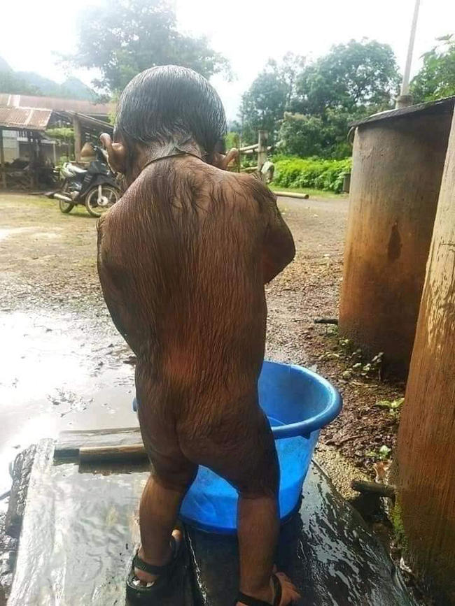 Xót xa nhìn bé trai với vẻ ngoài kì lạ, khắp người phủ kín đầy lông-3