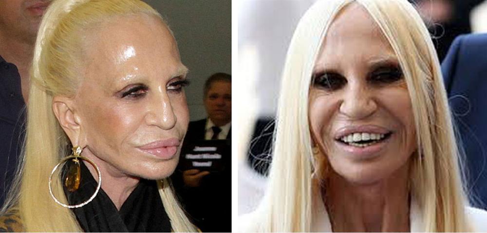 Cuộc đời đầy nước mắt phía sau ánh hào quang của Nữ vương đế chế Versace: Từ búp bê sống của anh trai đến thảm hoạ thẩm mỹ thời đại-12