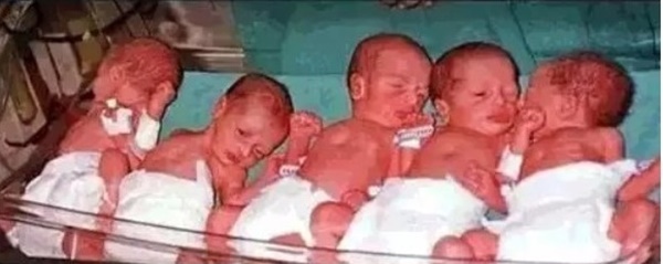 Mừng rỡ khi biết mình mang thai đôi, đến tháng thứ 5, bà mẹ chết sững khi nhìn vào màn hình siêu âm-7