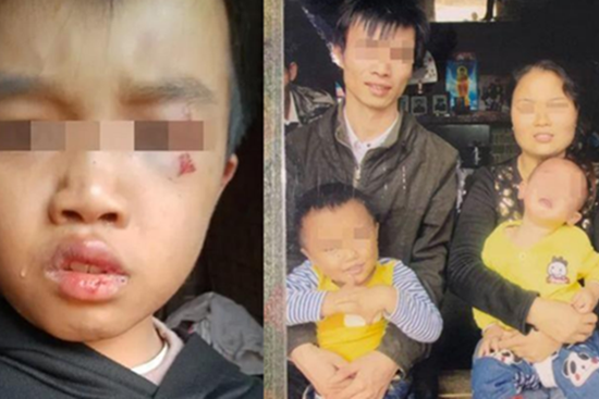 Bé trai bị bố mẹ hành hạ đến chết, ông nội nhận tin bủn rủn rồi bàng hoàng nhớ đến lời nói của đứa trẻ vài ngày trước với bà nội