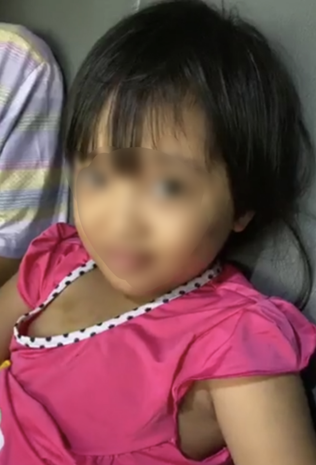 Bé gái 7 tuổi bị người tình của mẹ bạo hành dã man, dùng tàn thuốc châm vào ngực vì ngủ rồi tiểu trên nệm”-1