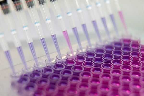 Kháng thể chống virus ở người nhiễm Covid-19 biến mất sau vài tháng-2