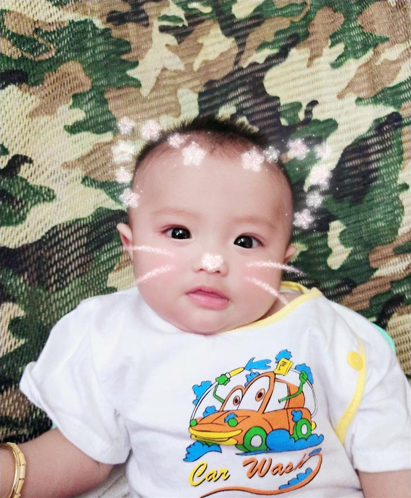 Người đàn ông Việt Nam đầu tiên mang thai kể chi tiết về ngày đi đẻ: 15 y bác sĩ vây xung quanh, đau như muốn rơi nội tạng ra ngoài-6