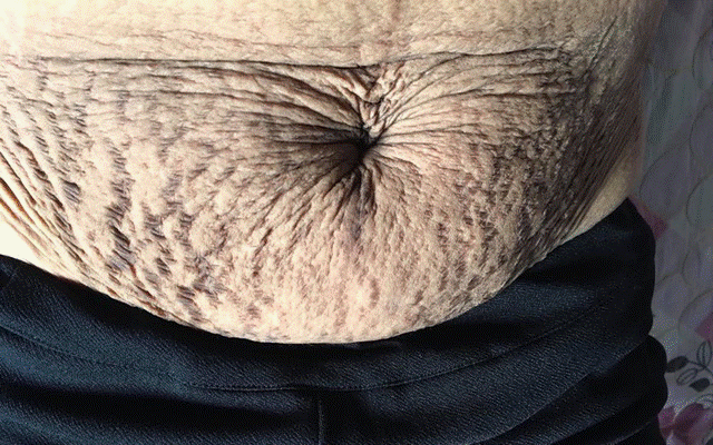 Nhiều mẹ sau khi sinh con xong đi ra đường bỗng bị gọi là bác, khoa học chứng minh sinh đẻ khiến phụ nữ già đi 11 năm tuổi là có thật!-2