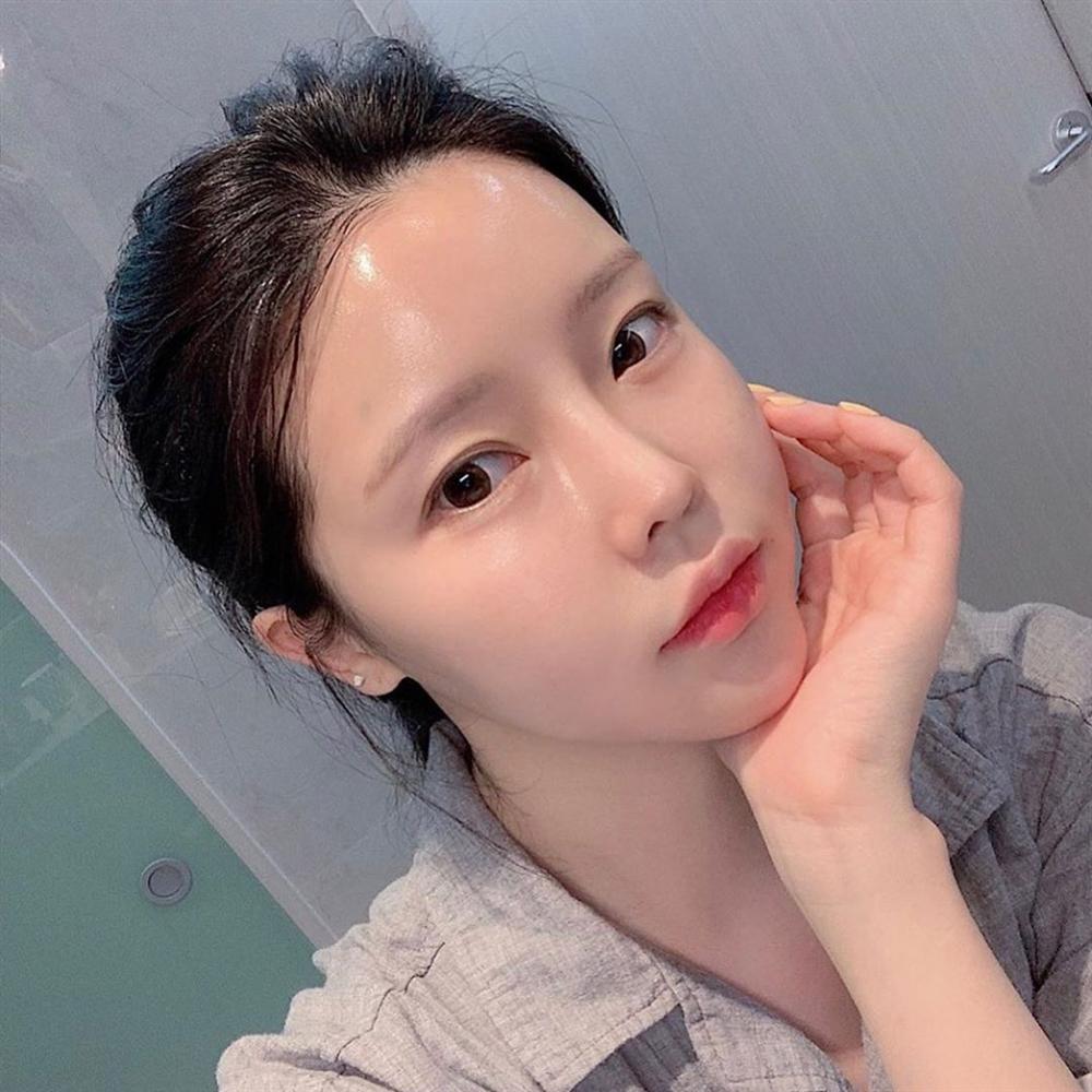 Sang Thu mà vẫn skincare như mùa Hè, tưởng là bình thường nhưng làn da sẽ lão hóa nhanh chóng-3