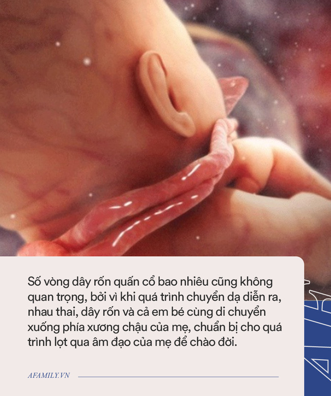 Hiếm gặp: Bé trai chào đời với 4 vòng dây rốn quấn cổ bằng phương pháp sinh thường-2