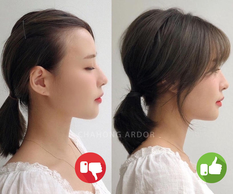 Hết Hari Won lại đến Thiều Bảo Trâm lộ trán sân bay, chẳng trách nhiều người không dám hất mái lên dù nóng-8