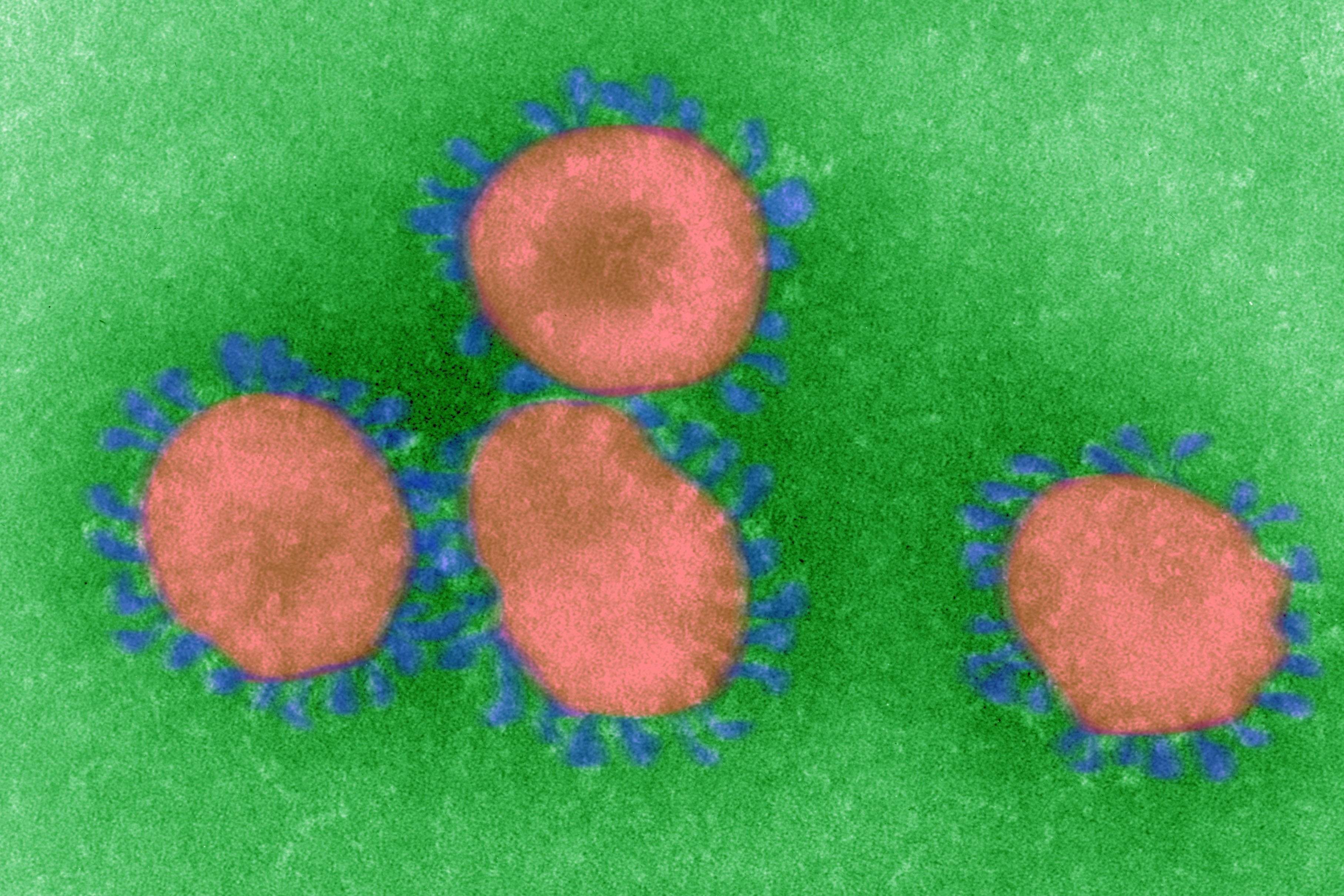 Virus lây nhiễm gấp 10 lần chủng ở Vũ Hán phát tán mạnh tại Châu Á-3