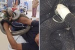 Thông tin bất ngờ vụ nhập viện cùng rắn hổ mang chúa 4,6 kg ở núi Bà Đen-2