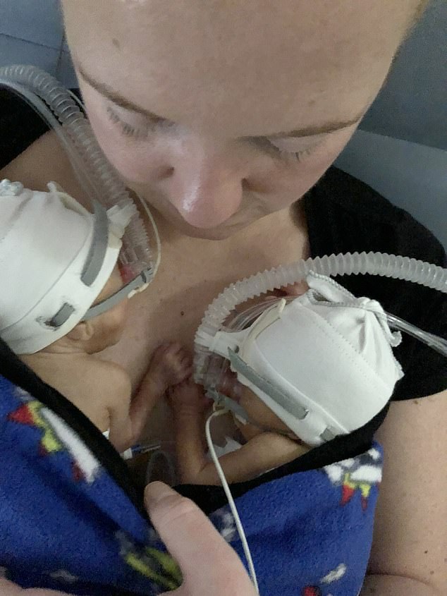 Đang chuyển dạ thì hết đau đẻ, bà mẹ bầu thai đôi sinh 2 con cách nhau hẳn 2 ngày-4