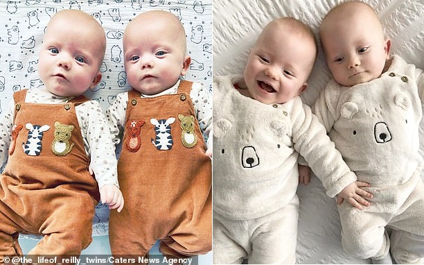 Đang chuyển dạ thì hết đau đẻ, bà mẹ bầu thai đôi sinh 2 con cách nhau hẳn 2 ngày-6