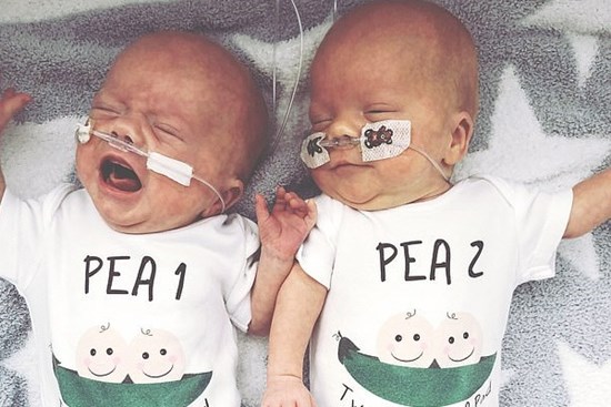 Đang chuyển dạ thì hết đau đẻ, bà mẹ bầu thai đôi sinh 2 con cách nhau hẳn 2 ngày