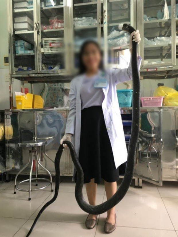 Thông tin bất ngờ vụ nhập viện cùng rắn hổ mang chúa 4,6 kg ở núi Bà Đen-1