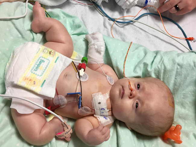 Gây sốt với clip chơi cầu trượt trên giường, ít ai biết rằng bé gái này mắc phải căn bệnh mà chỉ 1 cử động nhẹ cũng làm gãy xương-2