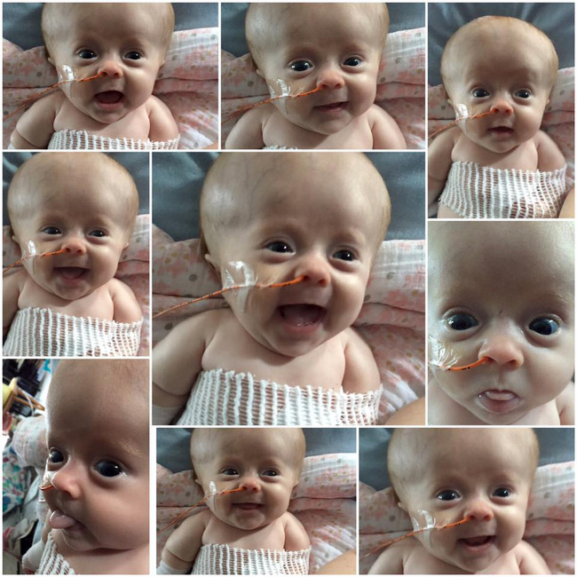 Gây sốt với clip chơi cầu trượt trên giường, ít ai biết rằng bé gái này mắc phải căn bệnh mà chỉ 1 cử động nhẹ cũng làm gãy xương-3