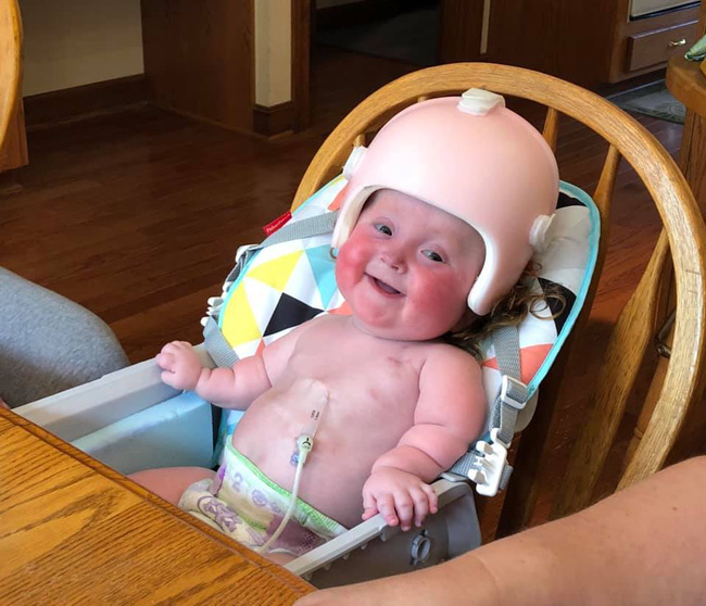 Gây sốt với clip chơi cầu trượt trên giường, ít ai biết rằng bé gái này mắc phải căn bệnh mà chỉ 1 cử động nhẹ cũng làm gãy xương-5