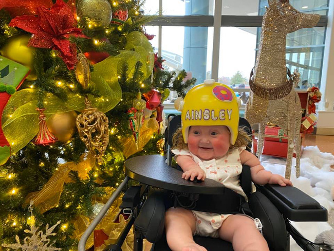 Gây sốt với clip chơi cầu trượt trên giường, ít ai biết rằng bé gái này mắc phải căn bệnh mà chỉ 1 cử động nhẹ cũng làm gãy xương-7