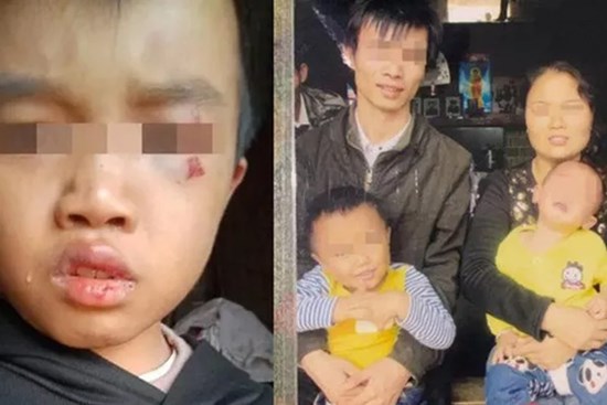 Bé trai bị bố mẹ hành hạ đến chết, ông nội nhận tin bủn rủn rồi bàng hoàng nhớ đến lời nói của đứa trẻ vài ngày trước với bà nội