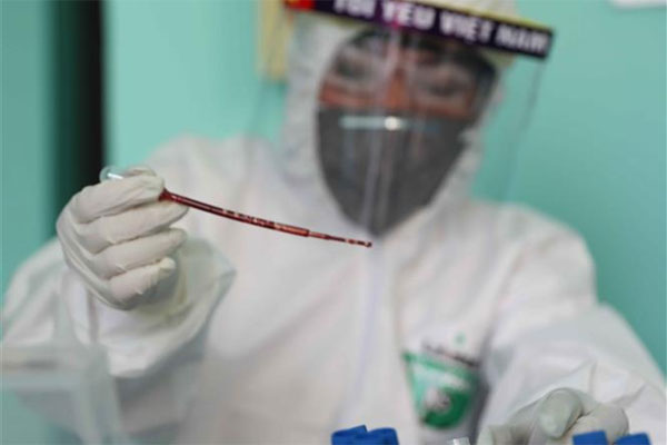 Quy trình lấy mẫu xét nghiệm nCoV bằng phương pháp rRT-PCR-1