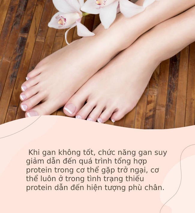 Bàn chân giống như đồng hồ sức khoẻ, 3 dấu hiệu này trên bàn chân cho biết rất có thể gan của bạn đang gặp vấn đề-3