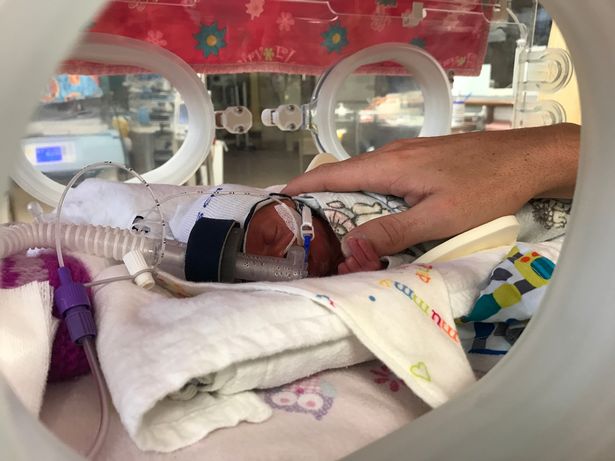 Chào đời với khối u lớn gấp rưỡi cơ thể, nhưng chỉ 1 năm sau ai nhìn em bé cũng bất ngờ-2