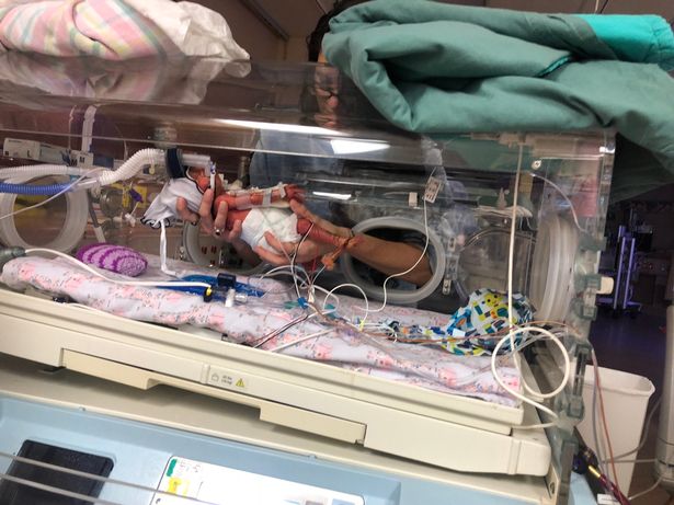 Chào đời với khối u lớn gấp rưỡi cơ thể, nhưng chỉ 1 năm sau ai nhìn em bé cũng bất ngờ-3