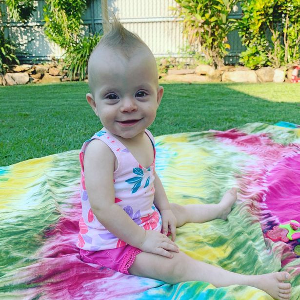 Chào đời với khối u lớn gấp rưỡi cơ thể, nhưng chỉ 1 năm sau ai nhìn em bé cũng bất ngờ-5