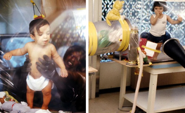 Em bé bong bóng: Cuộc đời 12 năm của đứa trẻ mắc căn bệnh quái ác bẩm sinh, ra đi với tương tác duy nhất trong đời là nụ hôn của mẹ-2