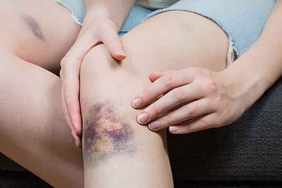 Có 4 thay đổi nhỏ trên cơ thể, hãy coi chừng vì có thể bệnh ung thư đang âm thầm tìm đến bạn