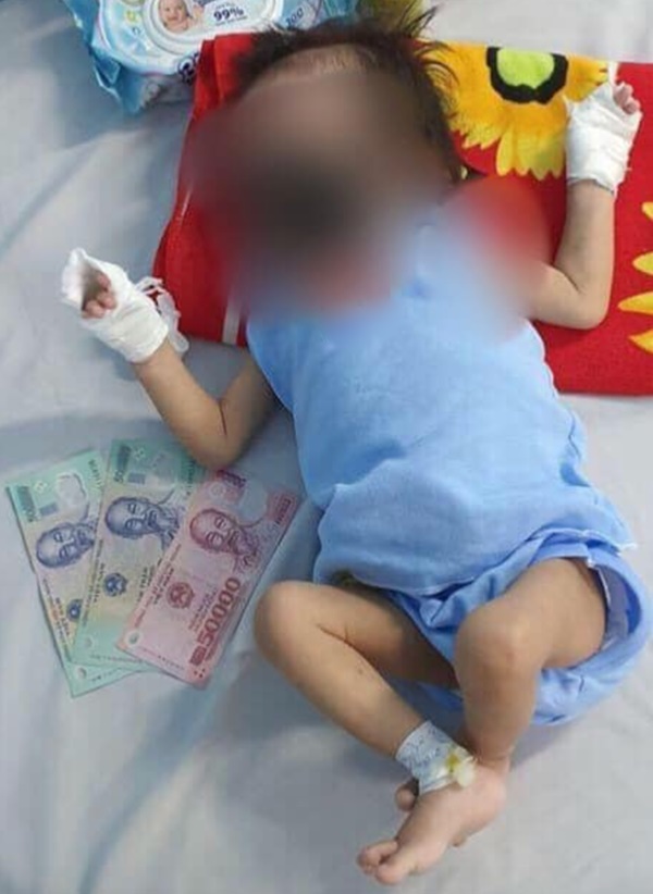 Kẻ gian nhẫn tâm lấy hình ảnh bé gái 15 tháng tuổi bỏng nặng đăng Facebook, bịa chuyện điều trị ở BV Chợ Rẫy để trục lợi-3