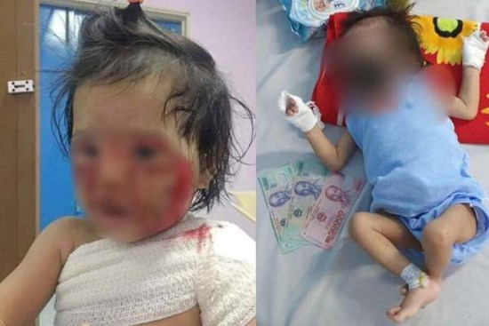 Kẻ gian nhẫn tâm lấy hình ảnh bé gái 15 tháng tuổi bỏng nặng đăng Facebook, bịa chuyện điều trị ở BV Chợ Rẫy để trục lợi