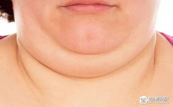 Người có tuổi thọ ngắn thường có đặc điểm 2 dày 3 cứng trên cơ thể, dù chỉ có 1 trong số đặc điểm này thì cũng không khỏe mạnh-2