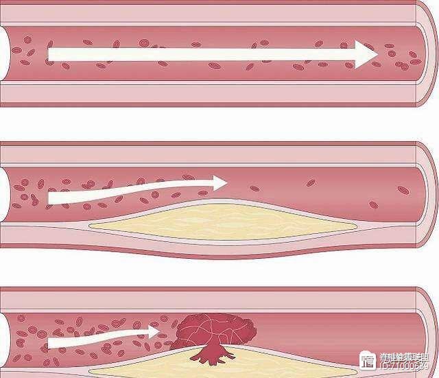 Người có tuổi thọ ngắn thường có đặc điểm 2 dày 3 cứng trên cơ thể, dù chỉ có 1 trong số đặc điểm này thì cũng không khỏe mạnh-4