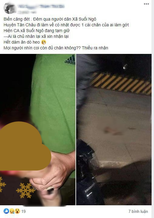 Đi làm đêm về, người dân bỗng dưng nhặt được một... cái chân nam giới đứt lìa, sau đó mới biết là hậu quả của vụ hỗn chiến giữa các nam thiếu niên-1