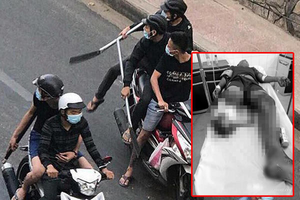 Mẹ thiếu niên bị chém ở Tây Ninh: Thấy bị chặn đường, Đ. quay đầu chạy thì bị đuổi theo chém rơi chân xuống-4