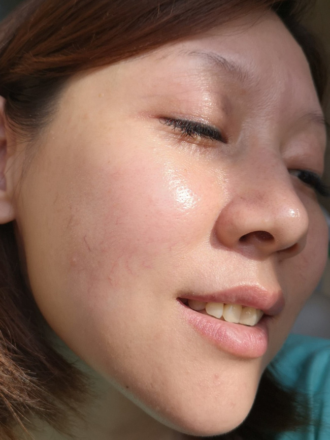 Da dẻ sẽ bớt khô nhăn và sần gồ ghề do lão hóa, nếu các nàng đầu tư vào 3 lọ serum này-2