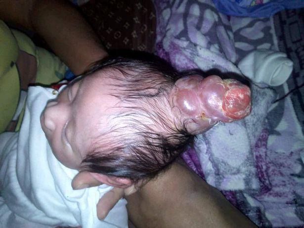 Đi khám thai đầy đủ và được thông báo thai nhi bình thường, bà mẹ choáng váng nhìn con chào đời có một cái sừng ở trên đầu-2